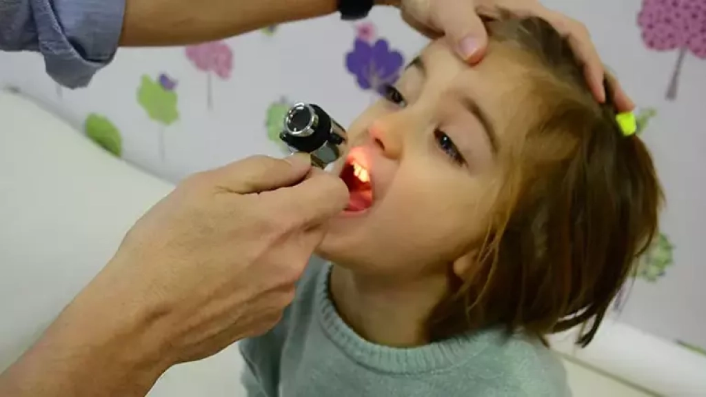 Romatizmal Ateş ve Streptokok Enfeksiyonu Sonrası Gelişen Artrit