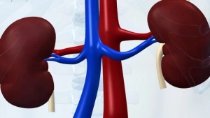 AKUT BÖBREK YETMEZLİĞİ